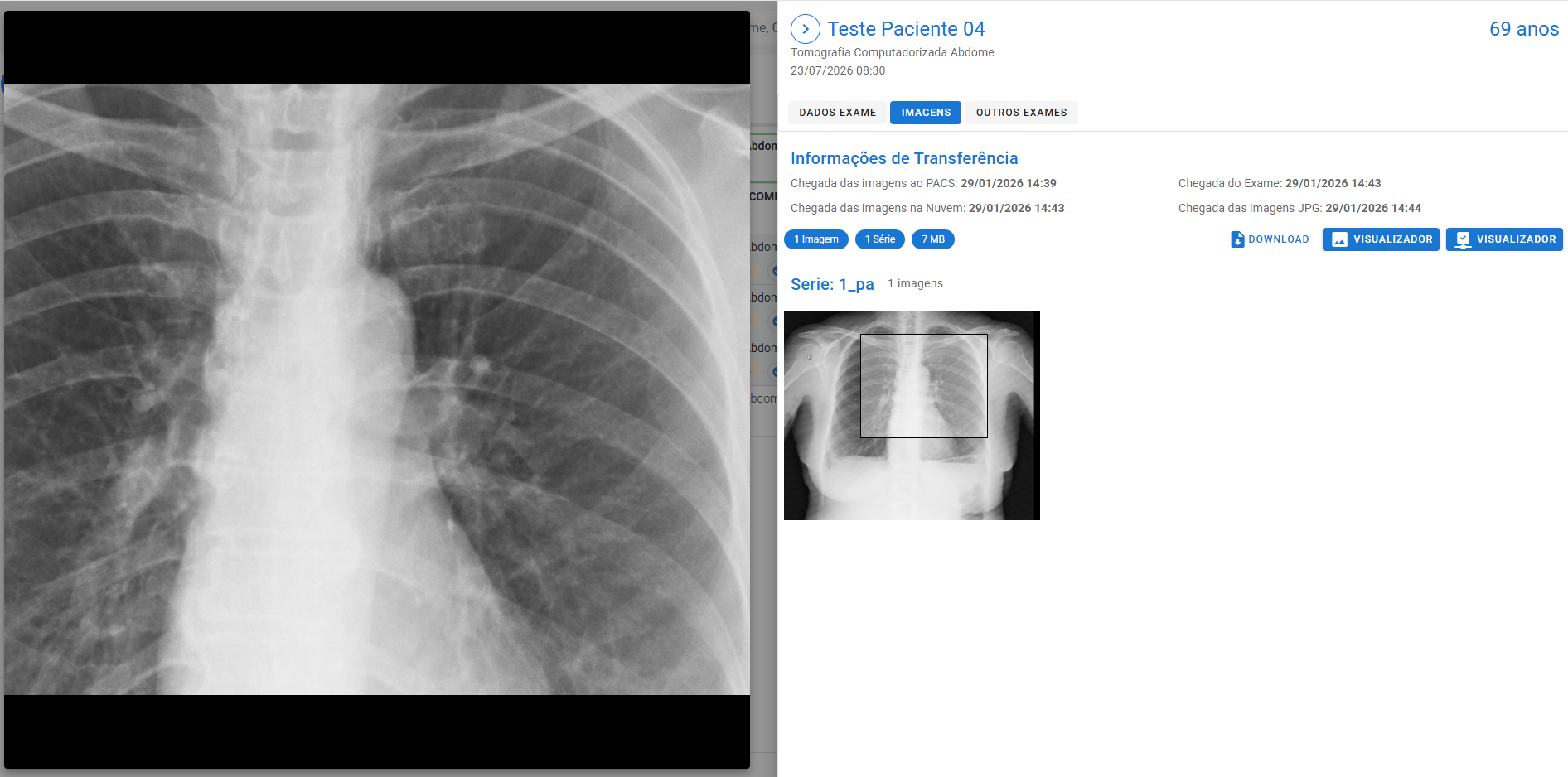 Visualizador de imagens médicas do Mezzow